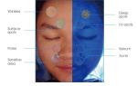 Support External Printer Skin Analysis System With Android 8.1 Operating