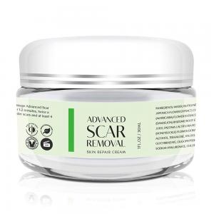 Best Wholesale Skin Scar Removal Cream for Pimple Acne Scar and Stretch Marks wholesale