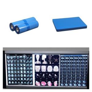 China Medical Inkjet X Ray Films For CT MRI DR CR Image Output Compatible With HP Printer on sale