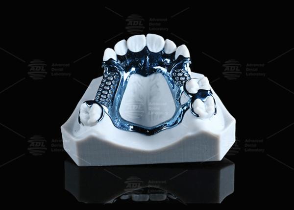 Cheap Anodized 3D Printed Titanium Framework Lightweight And Suitable For Sensitive Skin for sale