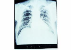 Best Dry X Ray Medical Diagnostic Imaging Radiology For AGFA / FUJI 2000 wholesale
