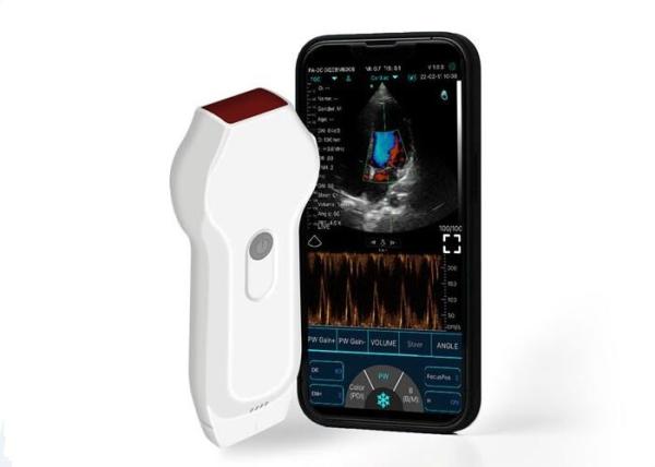 Cheap Personal Ultrasound Scanner Linear+Cardiac Probe 2.2MHz Mobile DICOM Format for sale