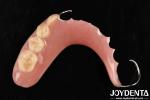 Elaborate Technology For Stable Oral Structure Framework Set Up Teeth Finish In