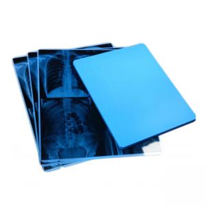 Best Dt 2b Mri Films For Fuji Agfa Lucky Hq Printer 14x17 Inch Diagnostic Imaging wholesale