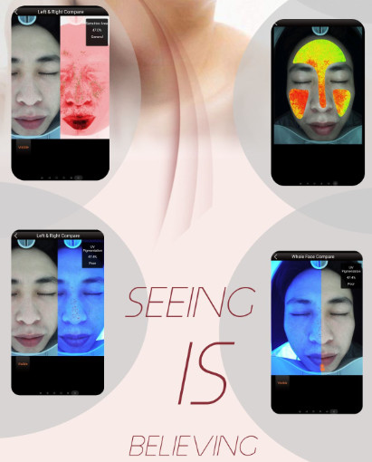 Handheld Equipment Analyzer Scanner Visia Skin Analysis System