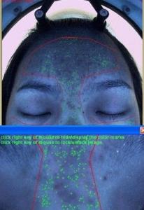 RGB Moisture Skin Analyzer Machine , Moisture Analysis with 3D Function