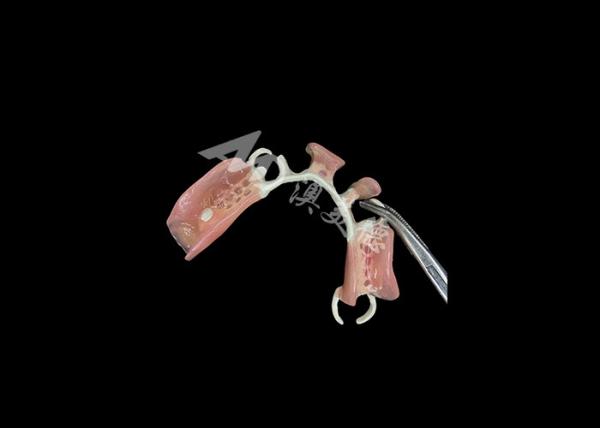 Cheap Lightweight and Durable HPP Framework Partial Dentures The Perfect Blend of Strength and Comfort for sale