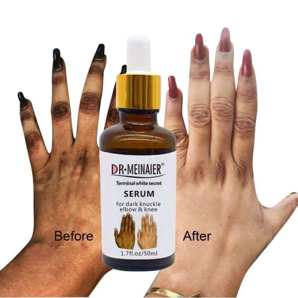 Cheap GMPC Bodycare Cosmetics Whitening Hand Knuckle Glow Serum For Removing Dark Knuckle Elbow for sale