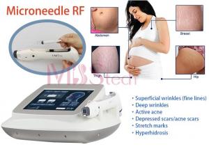 Best Stretch Marks Removal Face Lifting Rf Microneedle Machine wholesale