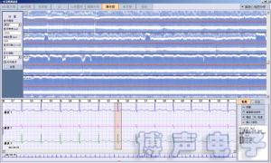 Best BORSAM PC Based EKG Analyzer Holter ECG Software System wholesale