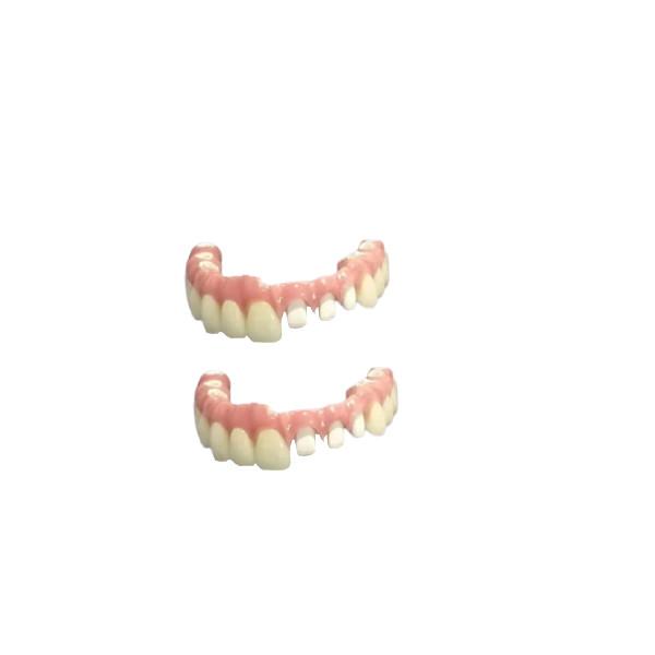 Cheap Resin-Based CAD-CAM Fixed Removable Bridge Aesthetics Restoration for sale