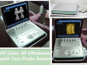 China Portable ultrasound& ultrasound machine portable &ultrasound diagnostic equipment on sale