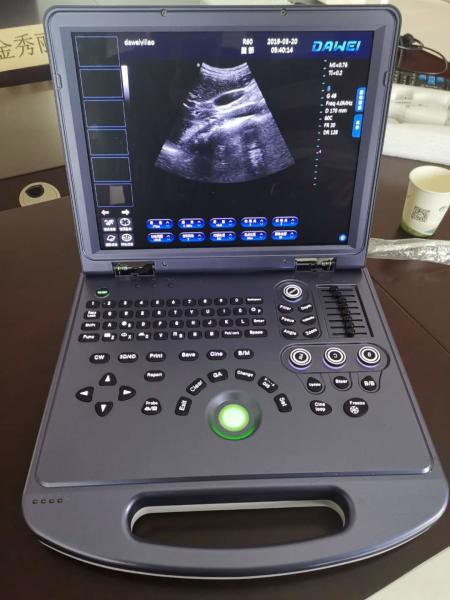 Cheap 2D Portable Ultrasound Machine With PC Platform AV220V 60Hz for sale