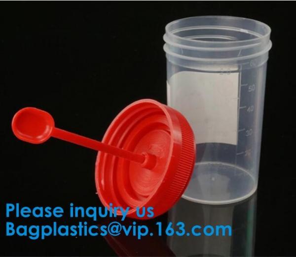 Sterile Disposable Hospital Sample 60ml 100 120 Ml Test Measurement Collection Urine Collector Cup Container