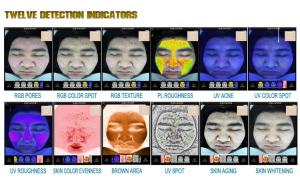Home Use Skin And Hair Analysis Machine With Shooting Analyzing Displaying Functions