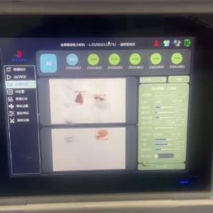 Best Walnut Kernel Sorting Machine AI-Powered Industrial-Grade Stability Real-Time Monitoring For Intelligent Nut Processing wholesale