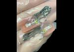 Customized Cast Partial Dentures Precision Metal Framework For Optimal Fit And