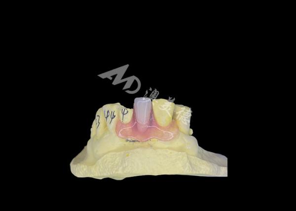 Cheap Nesbit Flexible Partial Denture for Comfort and Durability in Tooth Replacement for sale