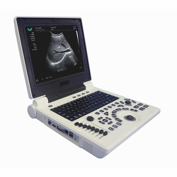 Cheap USG OB GYN Portable USG Machine IMT Automatic Measurement for sale