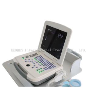 Best 96 elements Black and white Ultrasoudn Scanner used on clinic wholesale