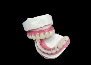 China Zirconia Dental Implant Crown Bridge All On 6 For Missing Teeth Replacement on sale