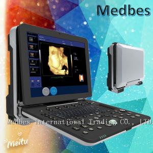 4D Portable Echocardiography Machine 4D Echo Color Digital Portable Ultrasound Machine