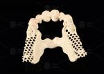 Milled Peek Framework Customizable Digital Partial Dentures Superior Thin