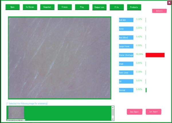 Cheap Professional Video Dermatoscope Analysis System With Analysis And Testing Report for sale
