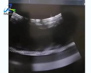 GE Voluson E10 Ultrasound Machine Repair Image Anomaly Replace Rfm Board