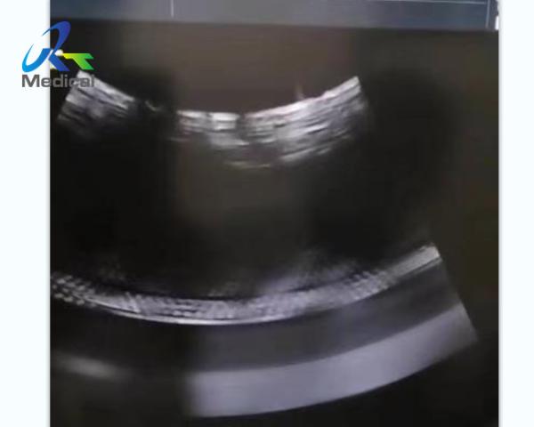Cheap GE Voluson E10 Ultrasound Machine Repair Image Anomaly Replace Rfm Board for sale