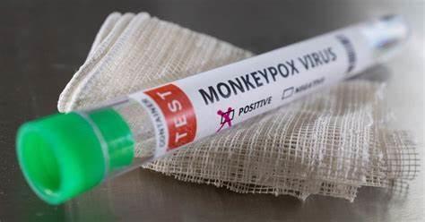Cheap Monkeypox Virus Detection Reagent Real Time PCR Kit for sale