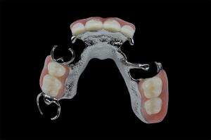 Best Customizable Removable Dentures Titanium Framework Dental Metal Framework wholesale