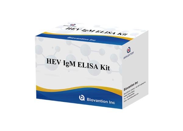 Cheap HEV IgM Elisa Test Kit Serum Vs Plasma For Antibody Detection for sale