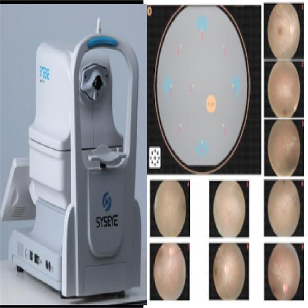 Cheap Intelligent Operate Non Mydriatic Wide Field Fundus Camera Automatic Alignment for sale