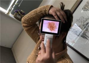 Wirelesss Optional USB Skin Camera Dermatoscope Video ENT Endoscope With 3.5 Inch Colorful TFT-LCD