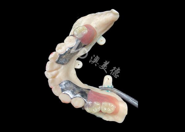 Cheap Customized Cast Partial Dentures Precision Metal Framework For Optimal Fit And Functionality for sale