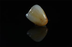 China Custom Stained Zirconia Crown from Leading China Dental Lab on sale