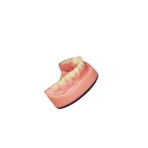 China Denture Dental lab PFM Dental Bridge 3D Digital Intraoral Scanning Imaging System on sale
