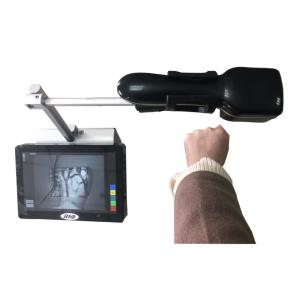 Portable Economical Infrared Vein Finder Detecting About 10mm Depth of Vein Trolley Available