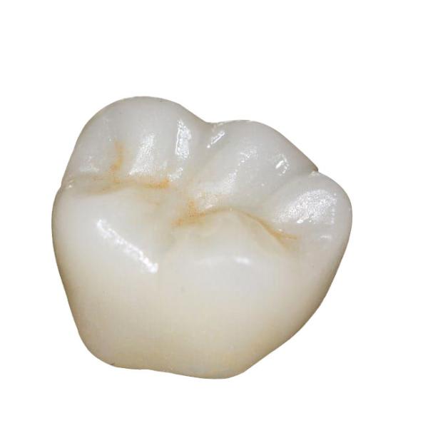 Cheap ISO Zirconia Dental Crown Computer Numerical Control Processing Good Biocompatibility for sale