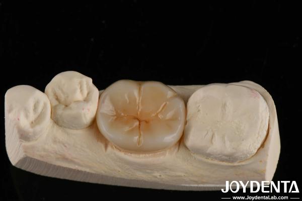 Cheap 800 MPa Flexural Strength And 8 MPa·m1/2 Fracture Toughness In Multilayer Full Zirconia For Strength Applications for sale