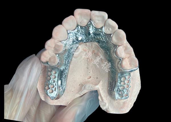 Cheap Custom Cast Partial Denture Dental Prosthetic Framework Without Teeth Set Up for Stability And Function for sale