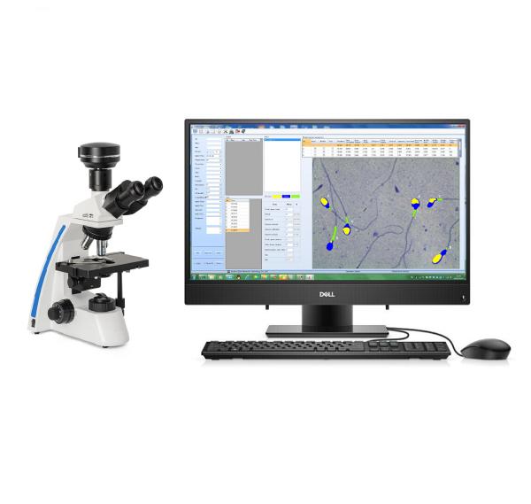 Cheap Semi Automatic Sperm Analysis System Computer Controlled Sperm Analyzer for sale