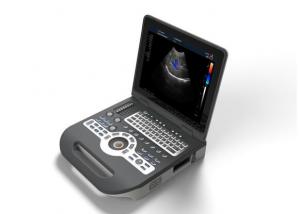 Best Portable Ultrasound Device Portable Ultrasound Scanner Color Doppler with 2 USB Ports wholesale