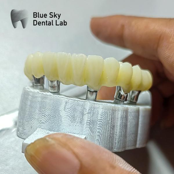 Cheap PMMA Bridge Implant Cases For Smooth Surface Implantation Scenarios for sale
