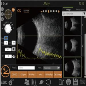 Best Mini Ultrasound Scanner Machine With Intelligent Digital Software Multiple IOL Calculation Formulas wholesale