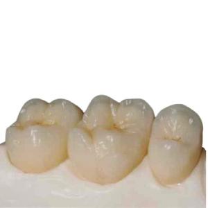 Best High Strength Zirconia Ceramic Teeth Precision Digitally Manufactured wholesale