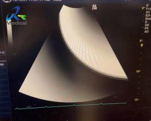 China GE Logiq S6 Ultrasound Machine Repair Displays Virtual Plot And No Echo Zone on sale