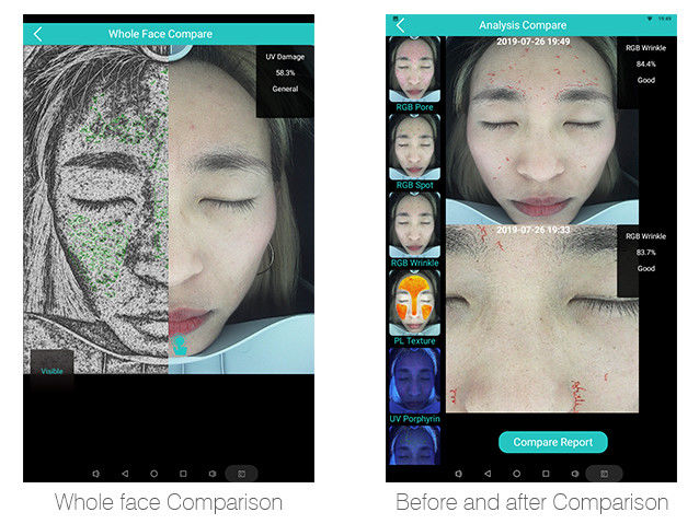 Support External Printer Skin Analysis System With Android 8.1 Operating Platform