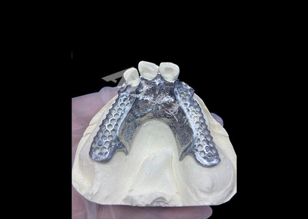 Cheap Easy Fit Custom Cast Partial Denture Stable and Natural-looking Framework for Fast Results for sale